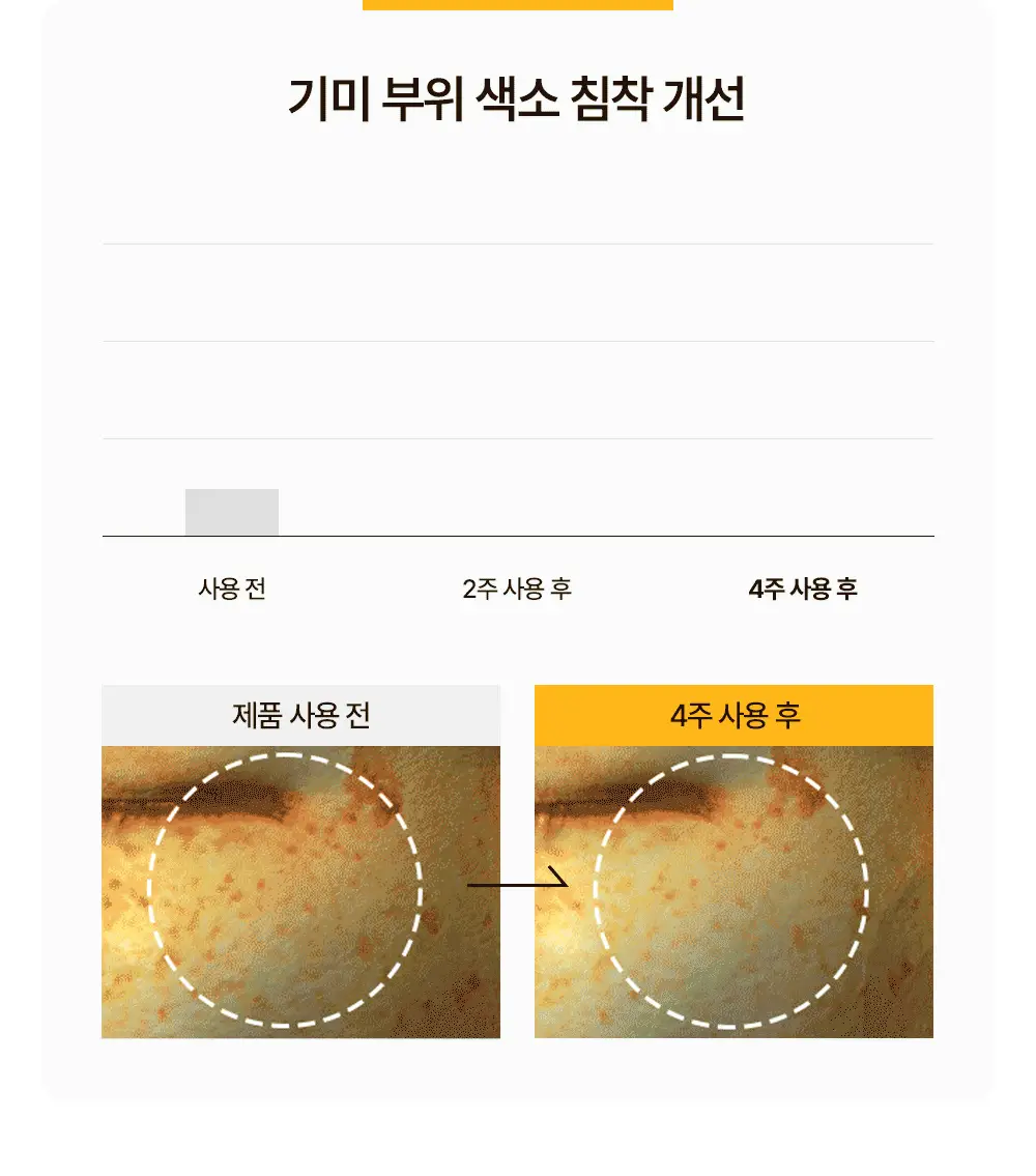 [기미/잡티/미백] 원진이펙트 멜라리스 크림 80g 상세페이지 17
